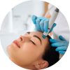 microneedling