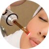 microneedling-rf